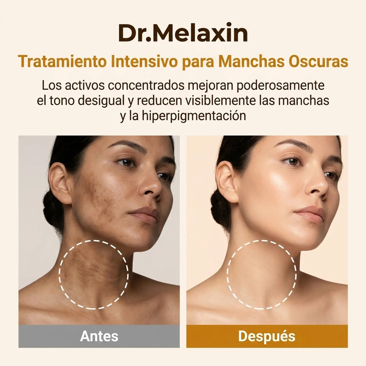 Dr Melaxin Spray™: Adiós a manchas y aclara tu piel en esas zonas oscuras