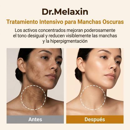 Dr Melaxin Spray™: Adiós a manchas y aclara tu piel en esas zonas oscuras
