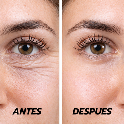 Oferta Especial 2x1: Crema Celyn™ Reafirmante Instantánea