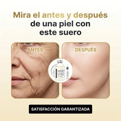 SungBoon™ Suero con efecto Lifting